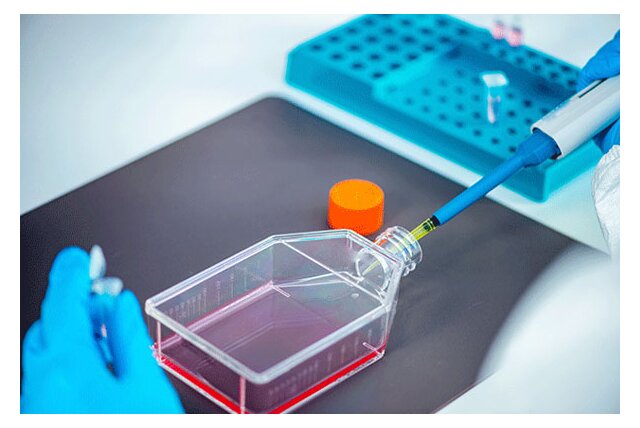Automation of cell culture: now is the time